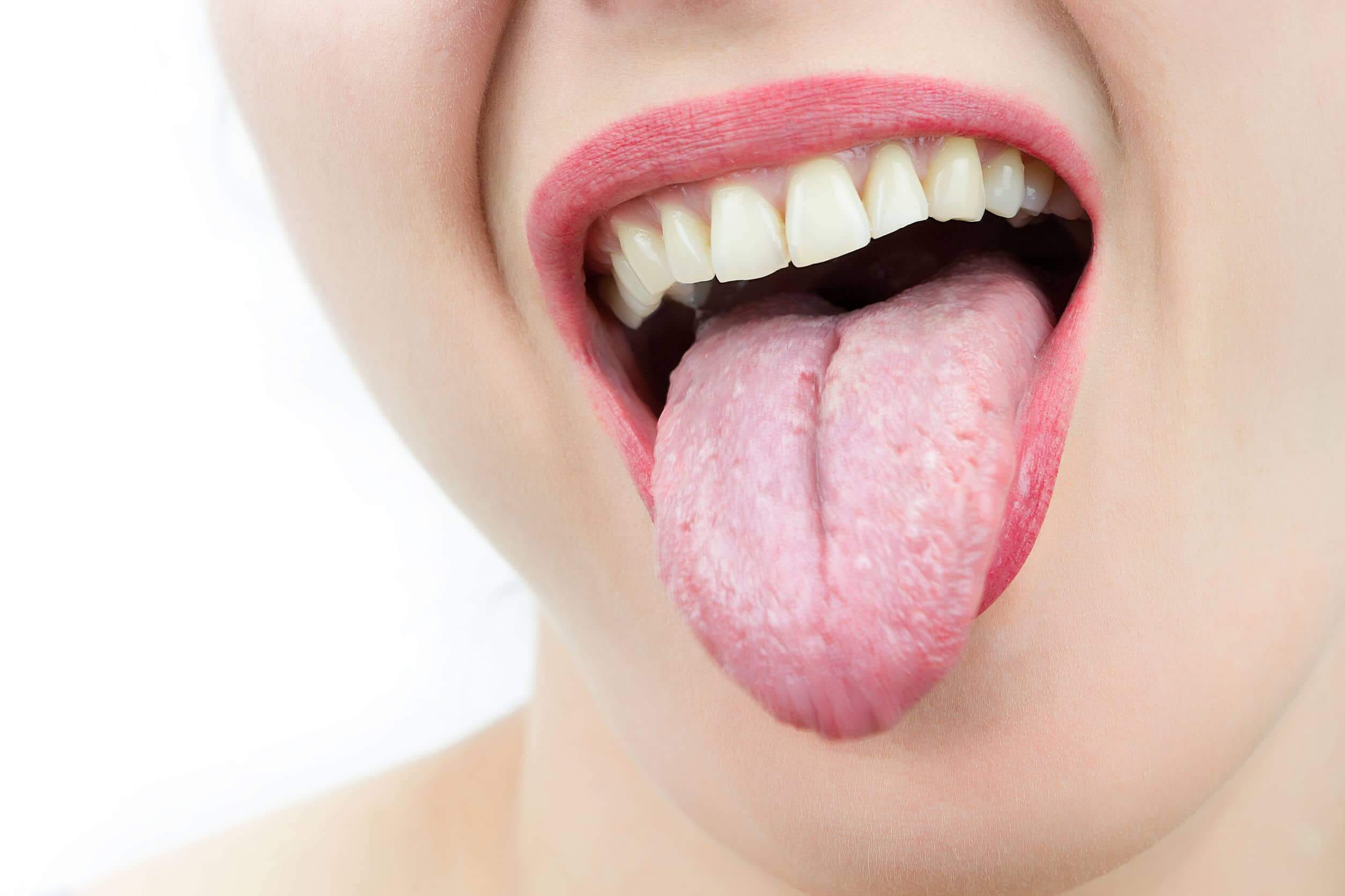 Eliminar las bacterias de la lengua - Clínica Dental Miguel Ángel García