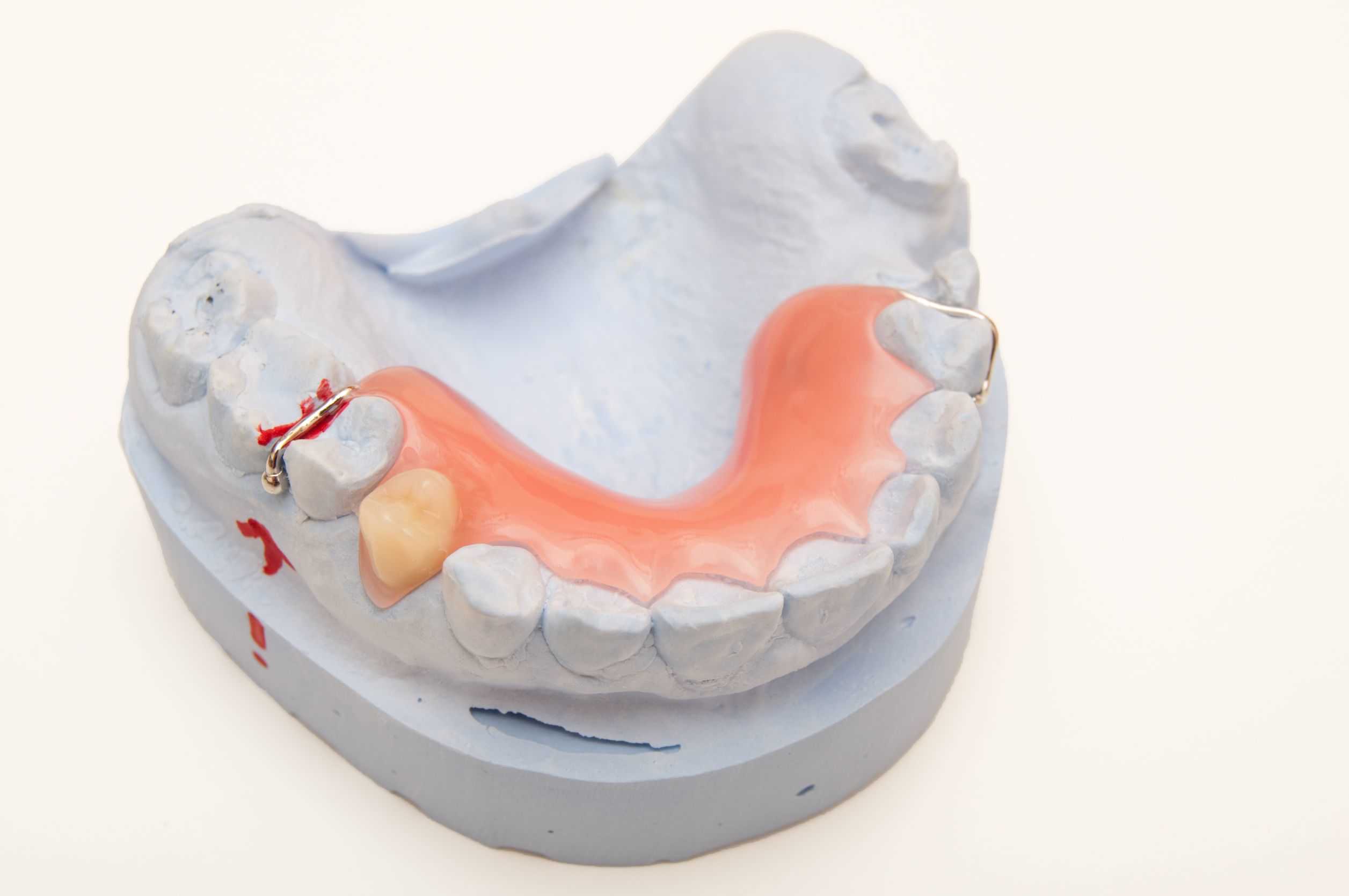 La necesidad de usar prótesis dentales