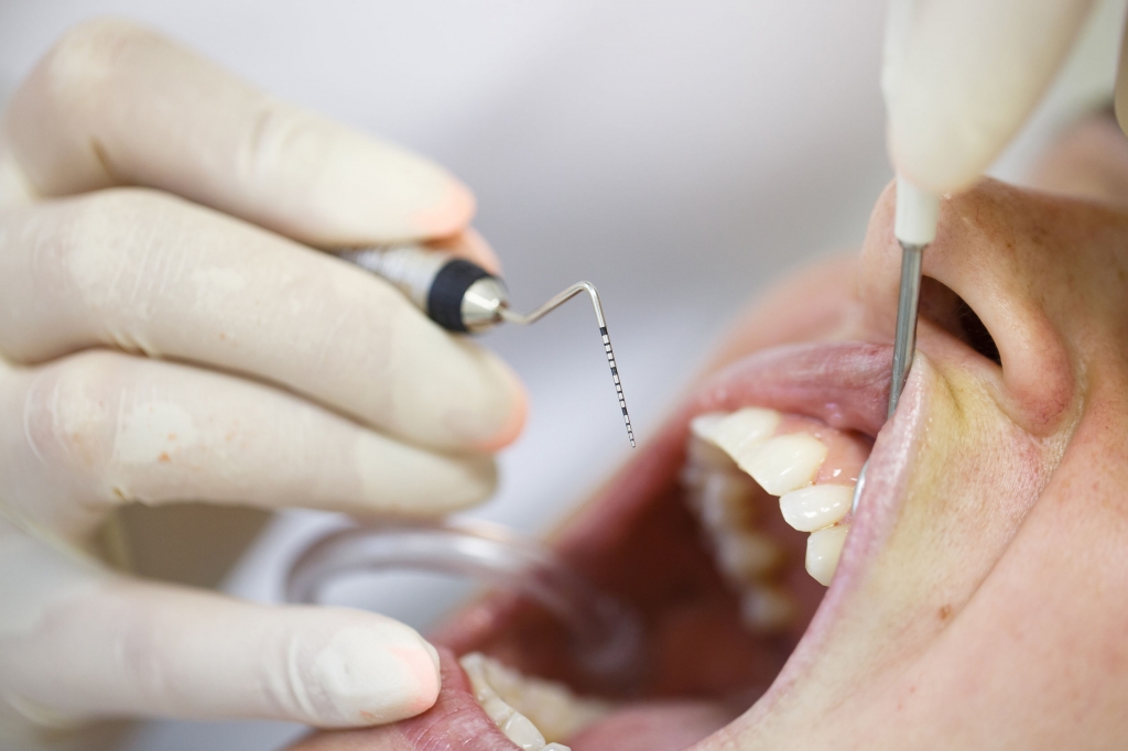 Cómo Prevenir La Enfermedad Periodontal I Clínica Miguel Ángel García