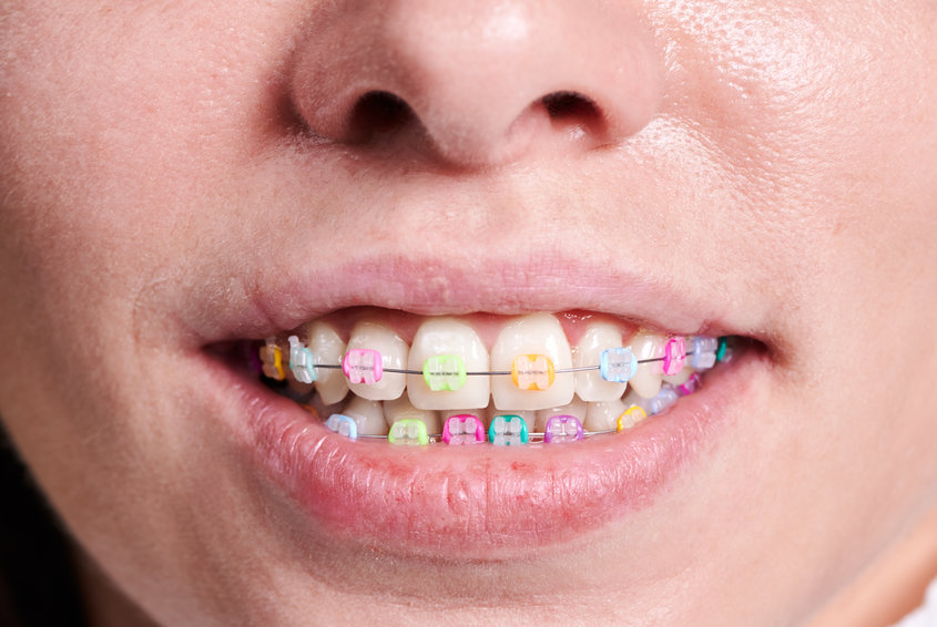 enfermedades dentales adolescentes